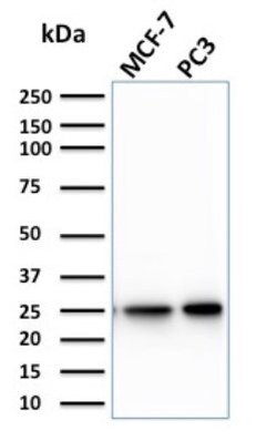 Chp2 Antibody (CPTC-CHP2-1) - Azide and BSA Free, Novus Biologicals 100 &mu;g | Buy Online | Novus Biologicals | Fisher Scientific